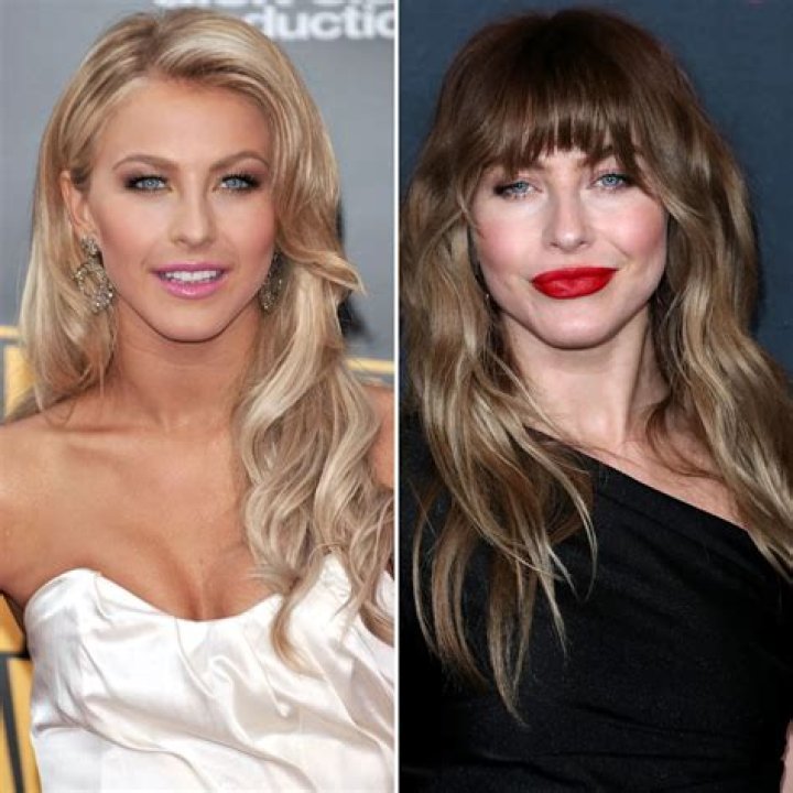 Has Julianne Hough Undergone Plastic Surgery: See Photos of Her Transformation