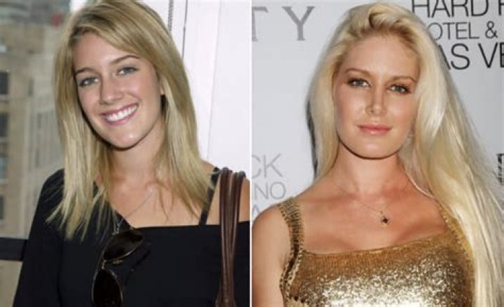 Heidi Montag’s Transformation From ‘Laguna Beach’ to Now: Plastic Surgery, Marriage, Motherhood