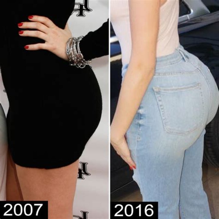 Is Khloe Kardashian’s Butt Real? See Her Booty Transformation Through the Years