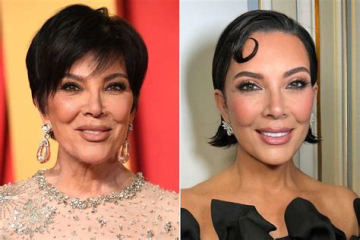 Kris Jenner’s ‘Unnatural’ Look Is a Result of Poorly Administered Fillers, Says a Plastic Surgeon