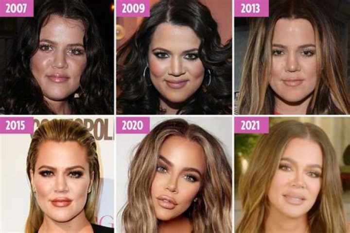 Ouch! Trolls Drag Khloé Kardashian Over Latest Selfie: ‘Lips Looking Botched’