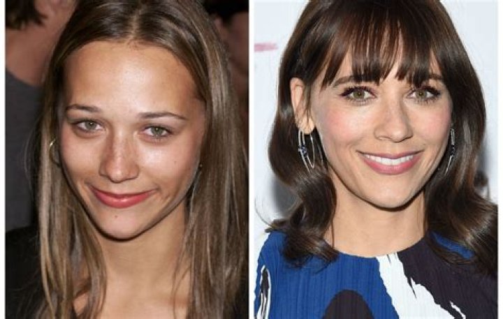 Plastic Surgery Experts Weigh in on Whether Rashida Jones Went Under the Knife!