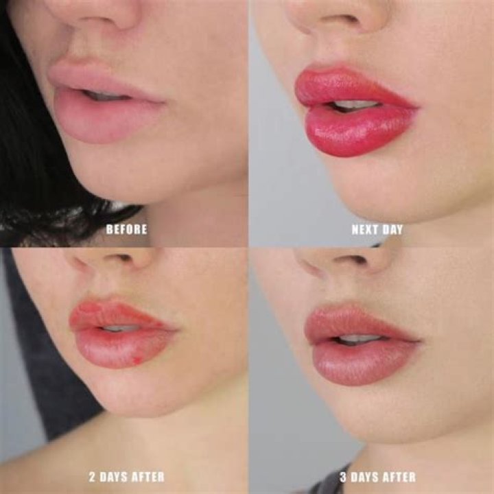 What is lip blushing?
