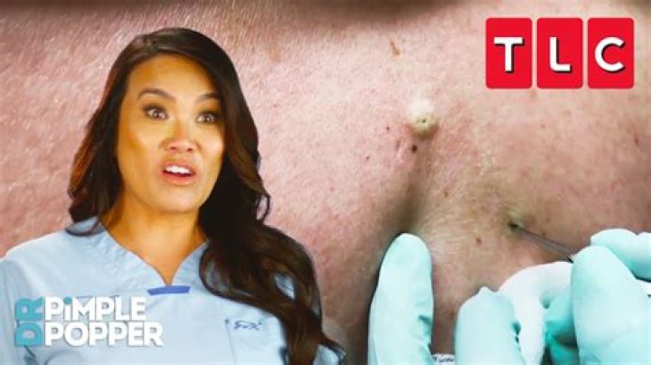 Who was Brittany Sharp on Dr. Pimple Popper?